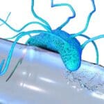 প্লাস্টিক-ইটিং এনজাইম